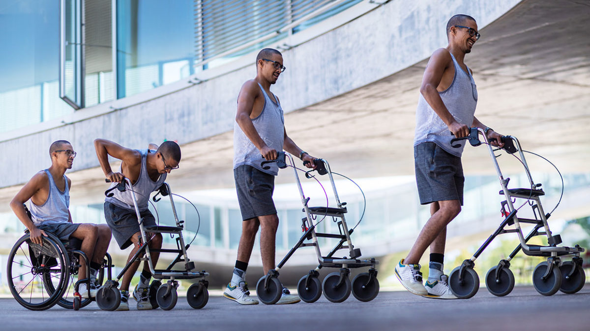 Spinal Stimulation Enables Three People With Paraplegia to Walk Again